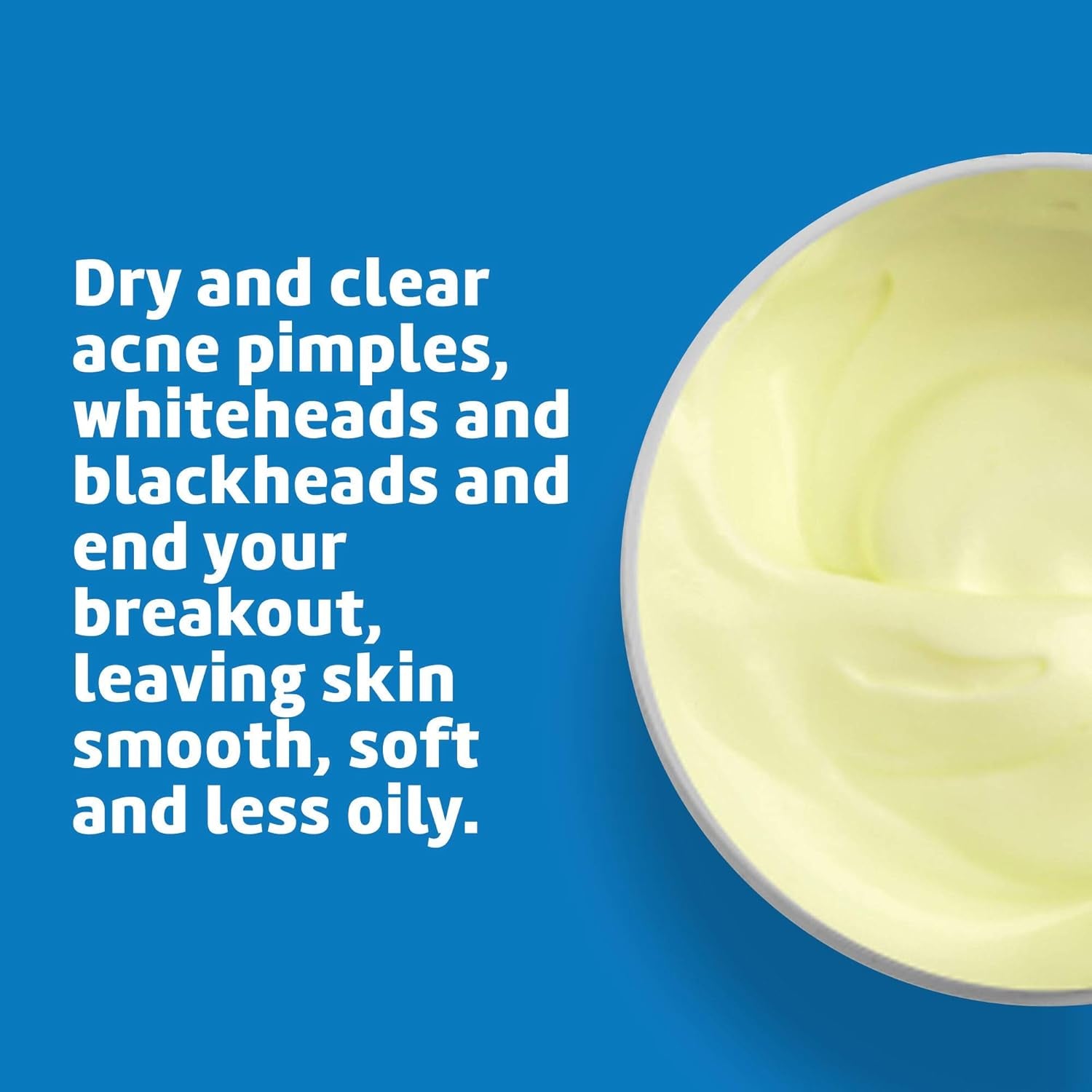 Sulfur Ointment - Cystic Acne Treatment for Face and Body - Daily 10 Min Spot Treatment Mask - Safe and Effective Game Changing Hormonal Acne Treatment That Clears up Pimples - 2.6 OZ