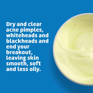 Sulfur Ointment - Cystic Acne Treatment for Face and Body - Daily 10 Min Spot Treatment Mask - Safe and Effective Game Changing Hormonal Acne Treatment That Clears up Pimples - 2.6 OZ